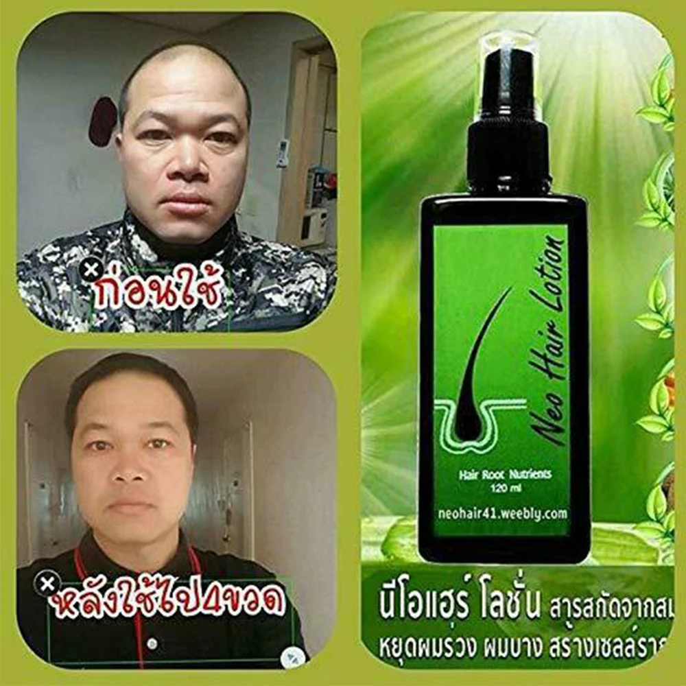  Горячая распродажа 120 мл Neo Лосьон для волос, сделанный в Таиланде Натуральная эссенция предотвращает выпадение волос Лечение кожи головы для мужчин и женщин Масло для роста волос