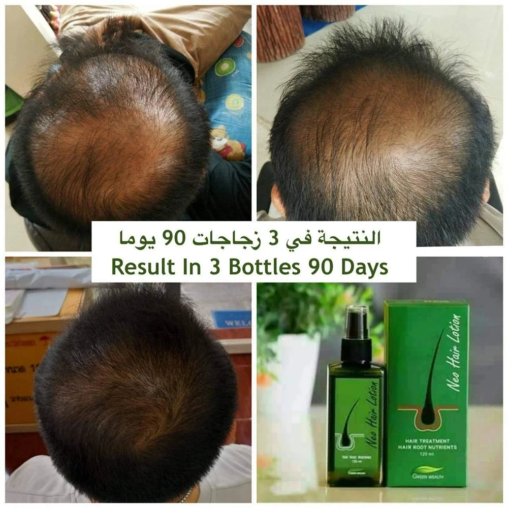  Горячая распродажа 120 мл Neo Лосьон для волос, сделанный в Таиланде Натуральная эссенция предотвращает выпадение волос Лечение кожи головы для мужчин и женщин Масло для роста волос